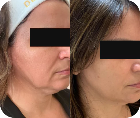 depoimento-1-6537eb29dd96e