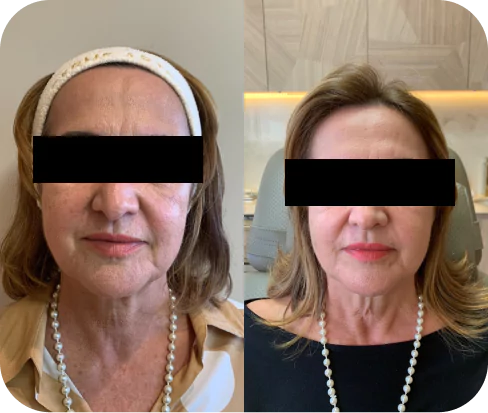 depoimento-2-6537eb29722e8