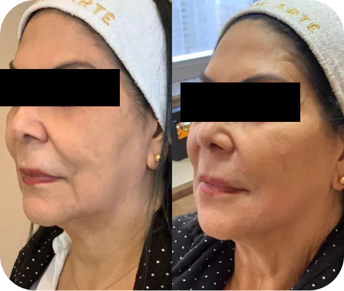 depoimento-3-6537eb2ac8b86