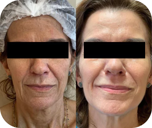 depoimento-4-6537eb2b15e34